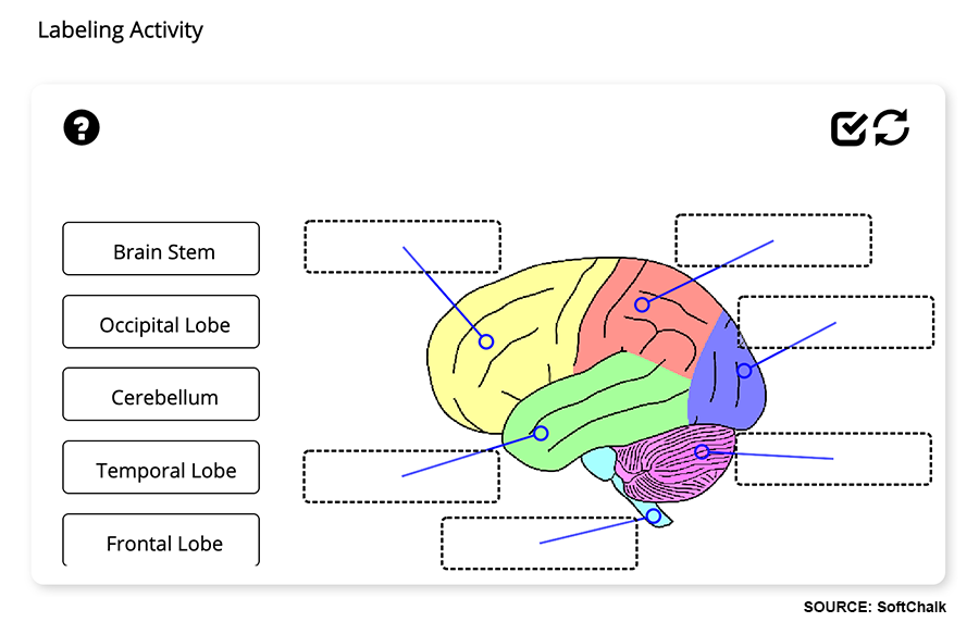A SoftChalk labeling activity of a human brain. Text of brain sections (brain stem, cerebellum, etc.) are dragged to the proper location on the brain graphic.